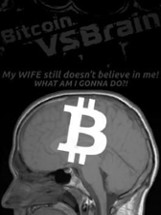 Bitcoin VS Brain Image