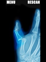 Simulator X-Ray - Finger Prank Image