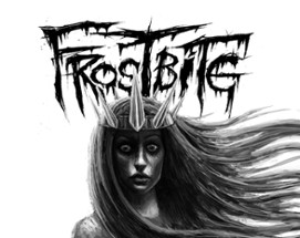 Frostbite Image