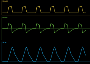 Vent (Beta) Image