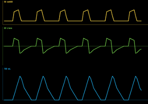 Vent (Beta) Image