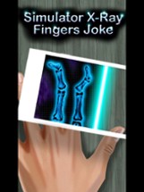 Simulator X-Ray Fingers Joke Image