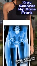 Xray Scanner Hip Bone Prank Image