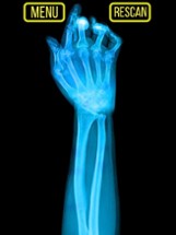 Xray Fracture Hand Prank Image