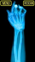 Xray Fracture Hand Prank Image