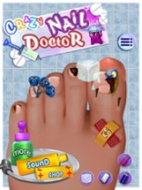 Crazy Toe Nail Doctor Surgery Image