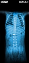 X-Ray Scanner Body Prank Image