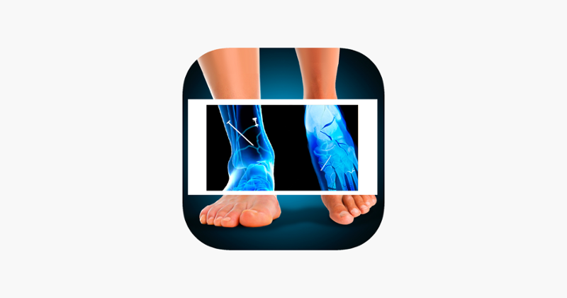 Xray Fracture Foot Prank Game Cover