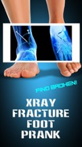 Xray Fracture Foot Prank Image