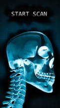 Simulator X-Ray Bone Fake Image