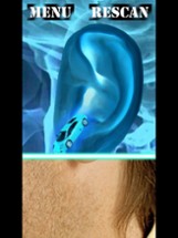 Xray Scanner Ear Prank Image