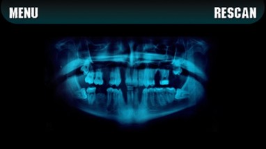 Simulator X-ray Teeth Prank Image
