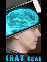 Simulator X-Ray Head Image
