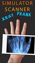 Simulator X-Ray Hand Image