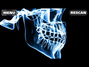 Xray Scanner Teeth Prank Image