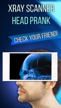 Xray Scanner Head Prank Image