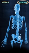 X-Ray Full Body Prank Image