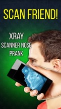 Xray Scanner Nose Prank Image